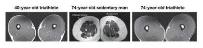 MRI scans comparing muscle tissue of a 40-year-old triathlete, a 74-year-old sedentary man, and a 74-year-old triathlete.