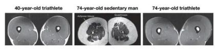 MRI cross-sections of leg muscles showing differences in muscle mass between a triathlete and a sedentary man at 40 and 74 years old.