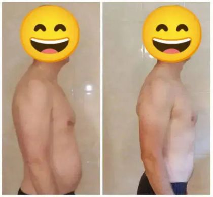 Side-by-side photos showing a man's transformation from a fuller figure to a leaner one, with smiley face emojis for anonymity.